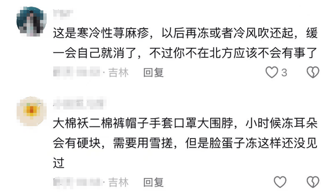 原創藍盈瑩吉林遊玩，零下24度戶外只待半個小時就被凍傷，臉又紅又腫