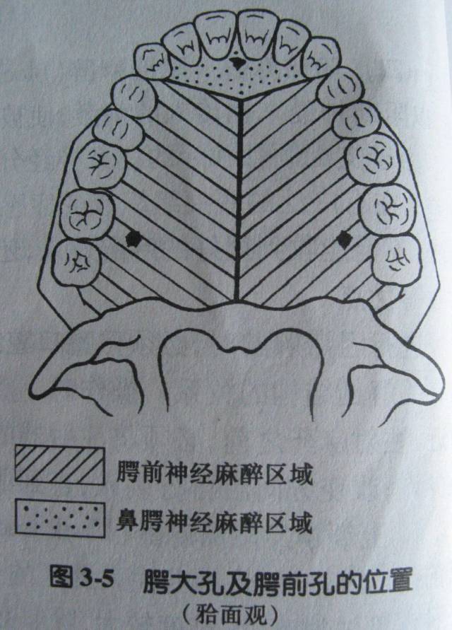 牙科必懂的口腔區域性麻醉