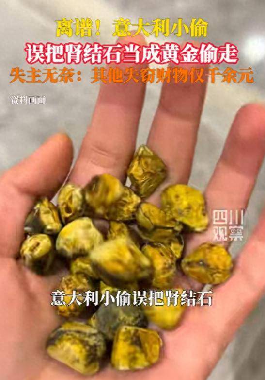 小偷誤將腎結石當黃金偷走，失主：兩塊腎結石用盒子裝著，小偷以為那是值錢的黃金
