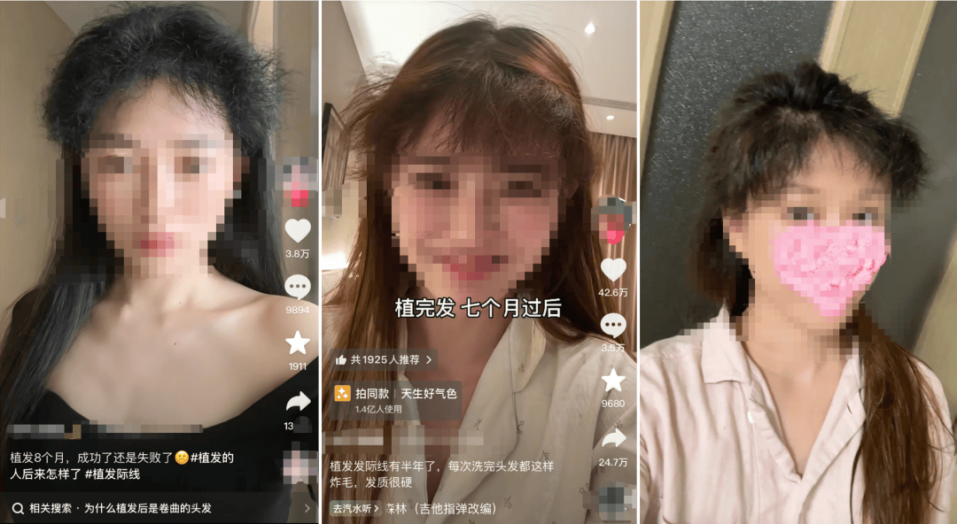 “割完”男人，“植髮一哥”雍禾又來抱女性大腿了
